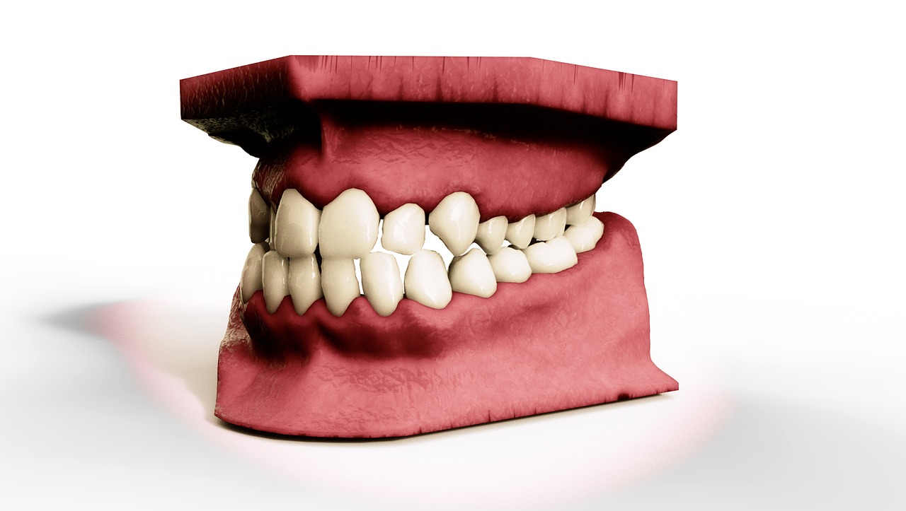 Applications of 3D Printing in Dentistry Industry